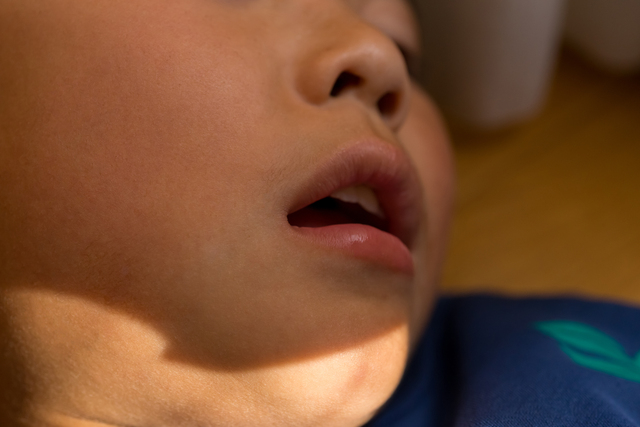 口呼吸の子どもが増えている理由と歯並びへの影響