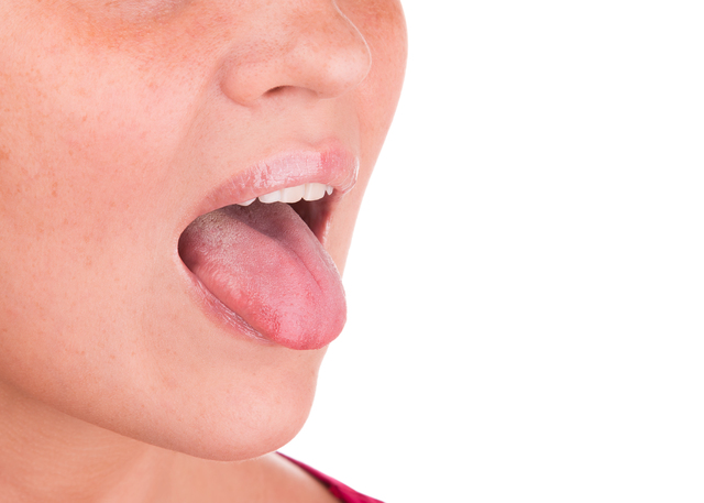 舌小帯の切除手術とは？発音・授乳への影響