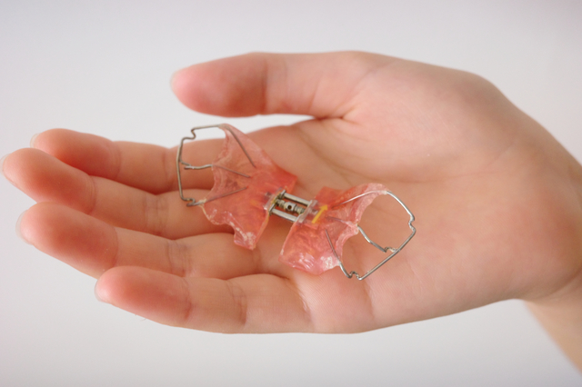 子どもの歯列矯正は早すぎると失敗する？開始時期の考え方