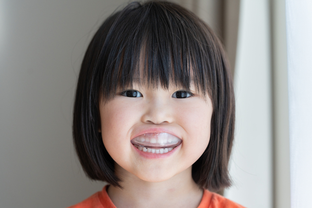 マウスピース矯正は子どもにも使える？メリットと注意点