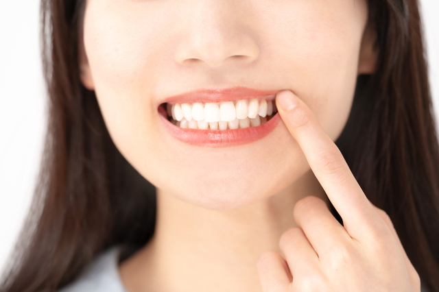 歯の黄ばみはなぜ起こる？原因別の改善方法